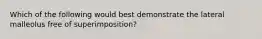 Which of the following would best demonstrate the lateral malleolus free of superimposition?