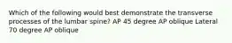 Which of the following would best demonstrate the transverse processes of the lumbar spine? AP 45 degree AP oblique Lateral 70 degree AP oblique