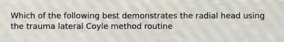 Which of the following best demonstrates the radial head using the trauma lateral Coyle method routine