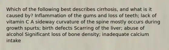 Which of the following best describes cirrhosis, and what is it caused by? Inflammation of the gums and loss of teeth; lack of vitamin C A sideway curvature of the spine mostly occurs during growth spurts; birth defects Scarring of the liver; abuse of alcohol Significant loss of bone density; inadequate calcium intake