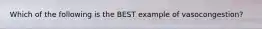 Which of the following is the BEST example of vasocongestion?