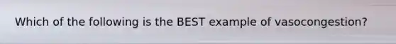 Which of the following is the BEST example of vasocongestion?