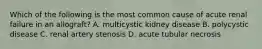 Which of the following is the most common cause of acute renal failure in an allograft? A. multicystic kidney disease B. polycystic disease C. renal artery stenosis D. acute tubular necrosis