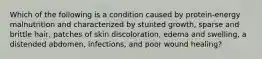 Which of the following is a condition caused by protein-energy malnutrition and characterized by stunted growth, sparse and brittle hair, patches of skin discoloration, edema and swelling, a distended abdomen, infections, and poor wound healing?