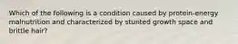 Which of the following is a condition caused by protein-energy malnutrition and characterized by stunted growth space and brittle hair?