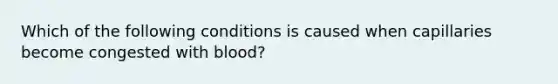 Which of the following conditions is caused when capillaries become congested with​ blood?