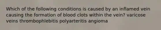 Which of the following conditions is caused by an inflamed vein causing the formation of blood clots within the vein? varicose veins thrombophlebitis polyarteritis angioma