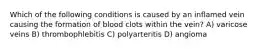 Which of the following conditions is caused by an inflamed vein causing the formation of blood clots within the vein? A) varicose veins B) thrombophlebitis C) polyarteritis D) angioma