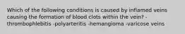 Which of the following conditions is caused by inflamed veins causing the formation of blood clots within the vein? -thrombophlebitis -polyarteritis -hemangioma -varicose veins