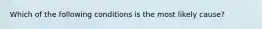 Which of the following conditions is the most likely cause?