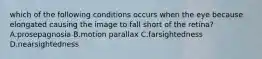 which of the following conditions occurs when the eye because elongated causing the image to fall short of the retina? A.prosepagnosia B.motion parallax C.farsightedness D.nearsightedness