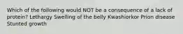 Which of the following would NOT be a consequence of a lack of protein? Lethargy Swelling of the belly Kwashiorkor Prion disease Stunted growth