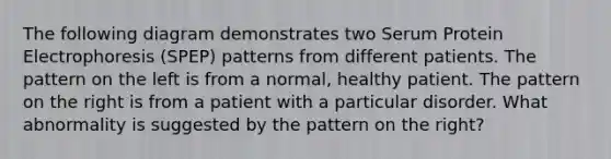 The following diagram demonstrates two Serum Protein Electrophoresis (SPEP) patterns from different patients. The pattern on the left is from a normal, healthy patient. The pattern on the right is from a patient with a particular disorder. What abnormality is suggested by the pattern on the right?