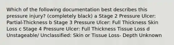 Which of the following documentation best describes this pressure injury? (completely black) a Stage 2 Pressure Ulcer: Partial-Thickness b Stage 3 Pressure Ulcer: Full Thickness Skin Loss c Stage 4 Pressure Ulcer: Full Thickness Tissue Loss d Unstageable/ Unclassified: Skin or Tissue Loss- Depth Unknown