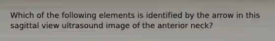 Which of the following elements is identified by the arrow in this sagittal view ultrasound image of the anterior neck?