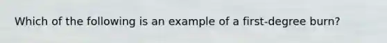 Which of the following is an example of a first-degree burn?