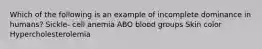 Which of the following is an example of incomplete dominance in humans? Sickle- cell anemia ABO blood groups Skin color Hypercholesterolemia