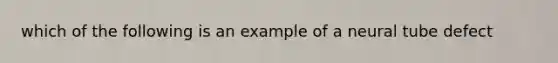 which of the following is an example of a neural tube defect