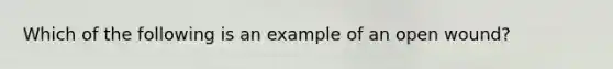 Which of the following is an example of an open wound?