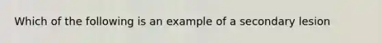 Which of the following is an example of a secondary lesion