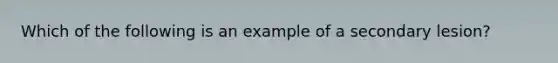 Which of the following is an example of a secondary lesion?