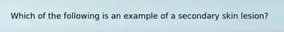 Which of the following is an example of a secondary skin lesion?