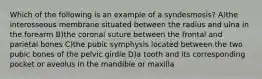 Which of the following is an example of a syndesmosis? A)the interosseous membrane situated between the radius and ulna in the forearm B)the coronal suture between the frontal and parietal bones C)the pubic symphysis located between the two pubic bones of the pelvic girdle D)a tooth and its corresponding pocket or aveolus in the mandible or maxilla