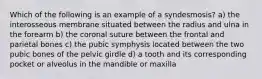 Which of the following is an example of a syndesmosis? a) the interosseous membrane situated between the radius and ulna in the forearm b) the coronal suture between the frontal and parietal bones c) the pubic symphysis located between the two pubic bones of the pelvic girdle d) a tooth and its corresponding pocket or alveolus in the mandible or maxilla