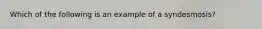 Which of the following is an example of a syndesmosis?