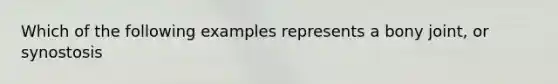 Which of the following examples represents a bony joint, or synostosis