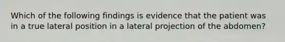 Which of the following findings is evidence that the patient was in a true lateral position in a lateral projection of the abdomen?