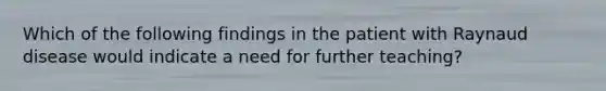 Which of the following findings in the patient with Raynaud disease would indicate a need for further teaching?