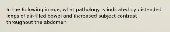 In the following image, what pathology is indicated by distended loops of air-filled bowel and increased subject contrast throughout the abdomen