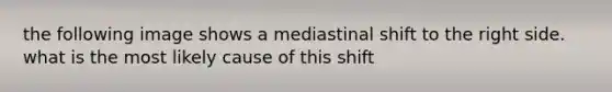 the following image shows a mediastinal shift to the right side. what is the most likely cause of this shift