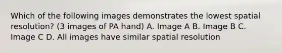 Which of the following images demonstrates the lowest spatial resolution? (3 images of PA hand) A. Image A B. Image B C. Image C D. All images have similar spatial resolution