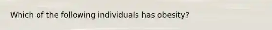 Which of the following individuals has obesity?