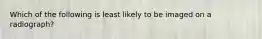 Which of the following is least likely to be imaged on a radiograph?