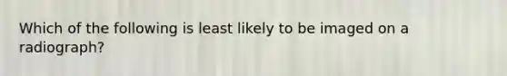 Which of the following is least likely to be imaged on a radiograph?