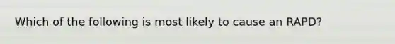 Which of the following is most likely to cause an RAPD?