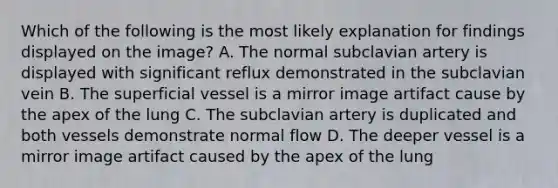 Which of the following is the most likely explanation for findings displayed on the image? A. The normal subclavian artery is displayed with significant reflux demonstrated in the subclavian vein B. The superficial vessel is a mirror image artifact cause by the apex of the lung C. The subclavian artery is duplicated and both vessels demonstrate normal flow D. The deeper vessel is a mirror image artifact caused by the apex of the lung