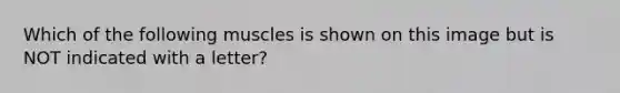 Which of the following muscles is shown on this image but is NOT indicated with a letter?