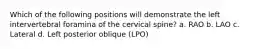 Which of the following positions will demonstrate the left intervertebral foramina of the cervical spine? a. RAO b. LAO c. Lateral d. Left posterior oblique (LPO)