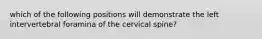 which of the following positions will demonstrate the left intervertebral foramina of the cervical spine?