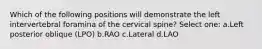 Which of the following positions will demonstrate the left intervertebral foramina of the cervical spine? Select one: a.Left posterior oblique (LPO) b.RAO c.Lateral d.LAO