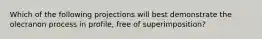 Which of the following projections will best demonstrate the olecranon process in profile, free of superimposition?