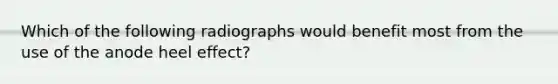 Which of the following radiographs would benefit most from the use of the anode heel effect?