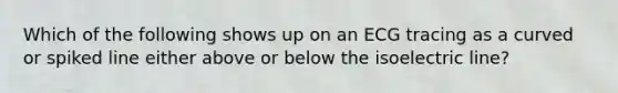 Which of the following shows up on an ECG tracing as a curved or spiked line either above or below the isoelectric line?​