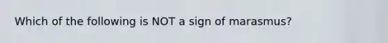 Which of the following is NOT a sign of marasmus?