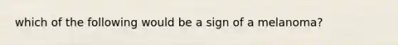 which of the following would be a sign of a melanoma?