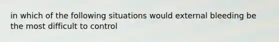 in which of the following situations would external bleeding be the most difficult to control